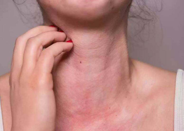 DSÖ o maddeyi kansorejen ilan etti: İçecekler, yoğurt, çikolata ve sakızda var - Resim: 16